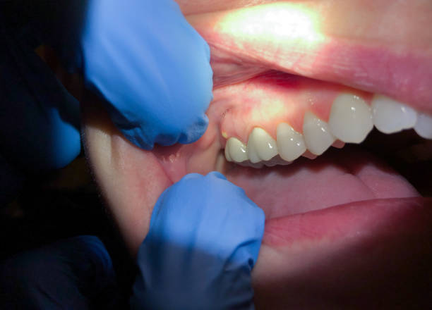Best Emergency Tooth Extraction  in Orland, CA